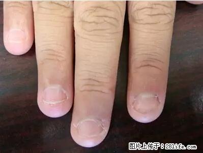 剪指甲、挖耳屎，这些日常小动作竟隐藏大危害！ - 泸州生活资讯 - 泸州28生活网 luzhou.28life.net